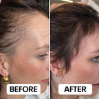 Aurea® – Scalp Renewal System 2.0