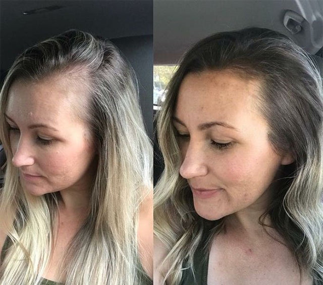 Aurea scalp massage detail