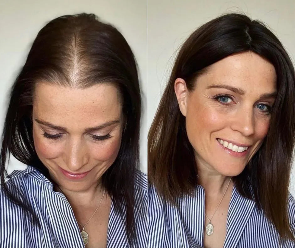 Aurea® – Scalp Renewal System 2.0