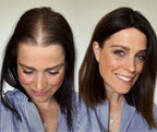 Aurea® – Scalp Renewal System 2.0