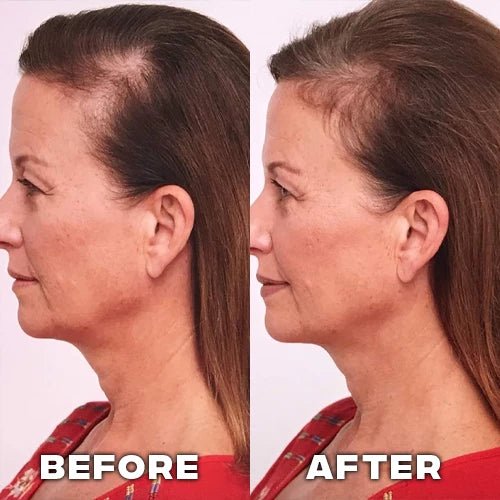 Aurea® – Scalp Renewal System 2.0